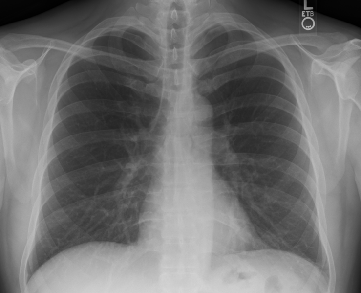 Doubt you know the doctor who read your Chest Xray